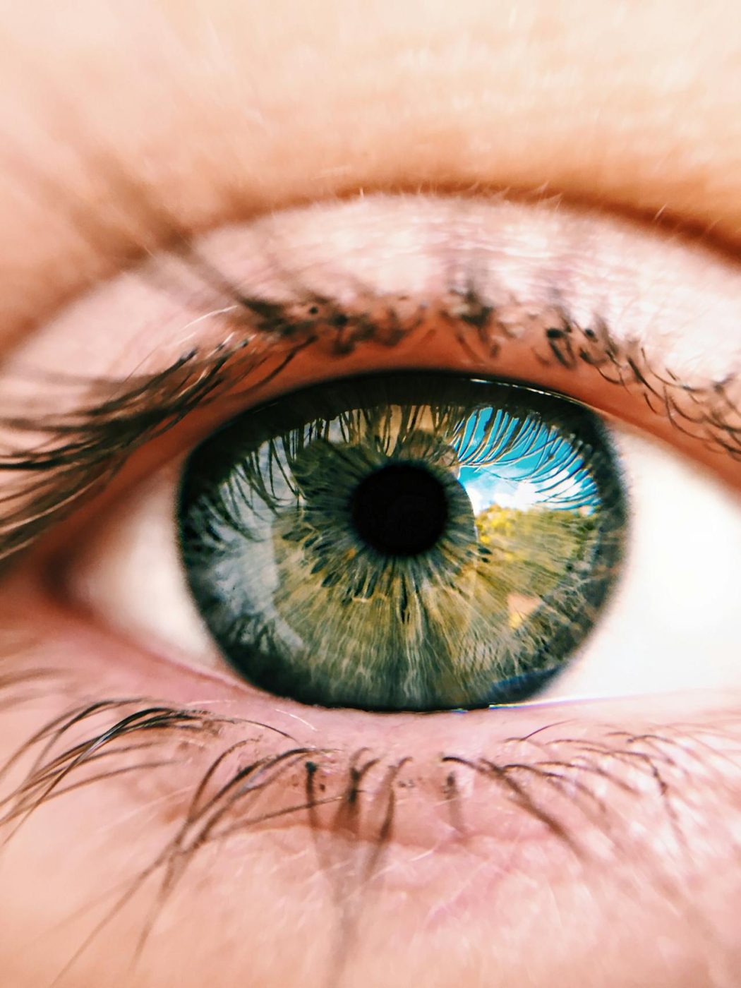 does lasik change eye color