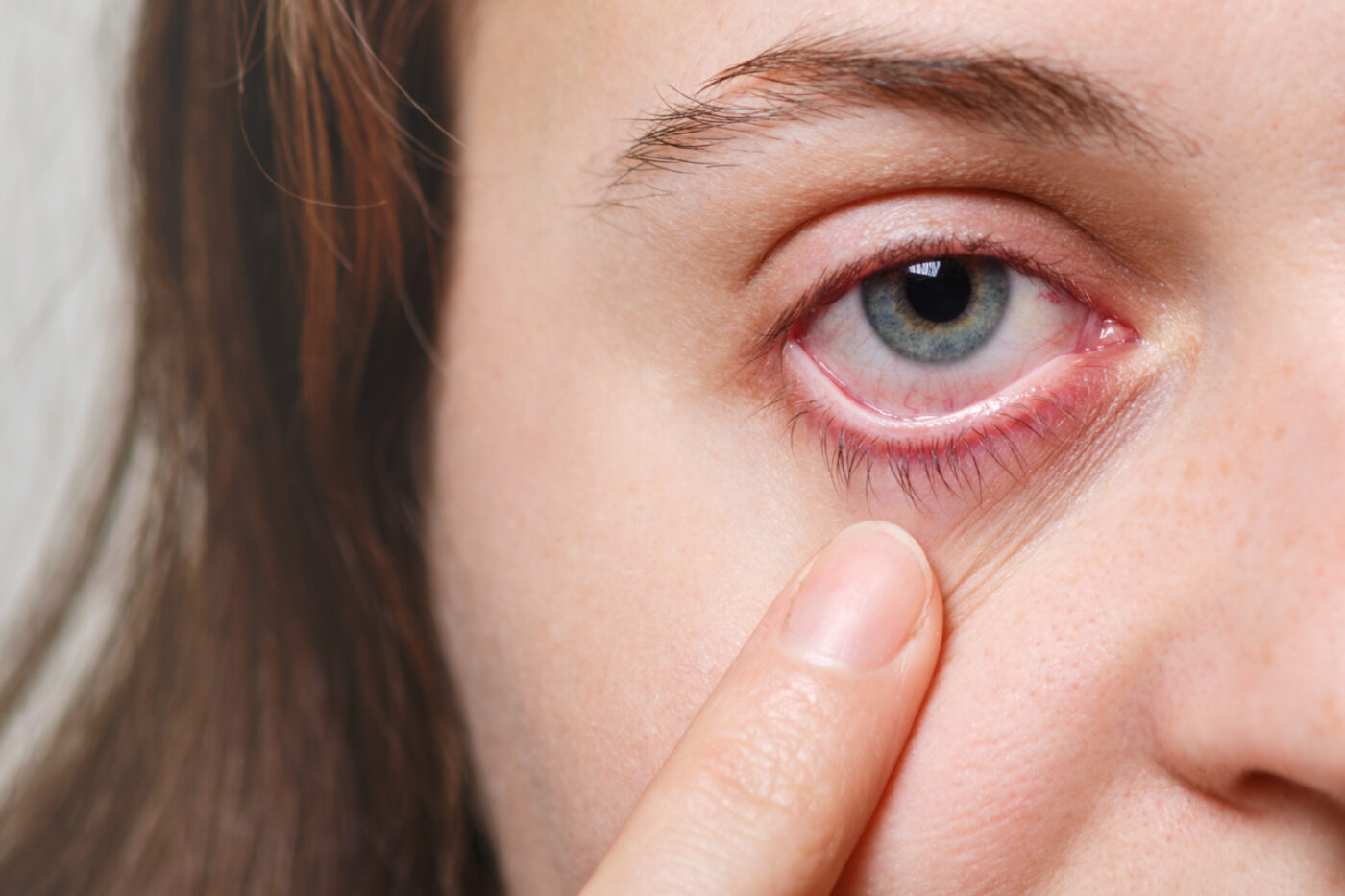 Contact lenses cause eye infection